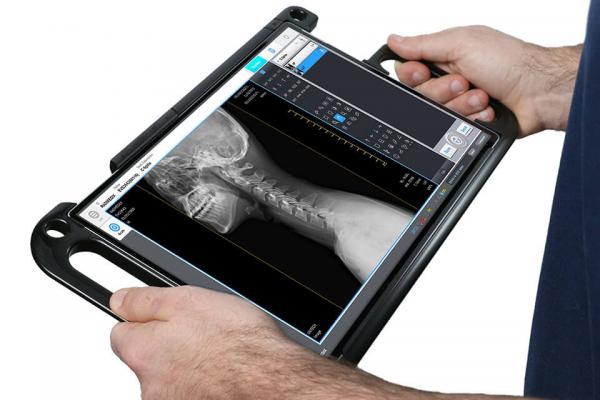 Portable X-Ray System